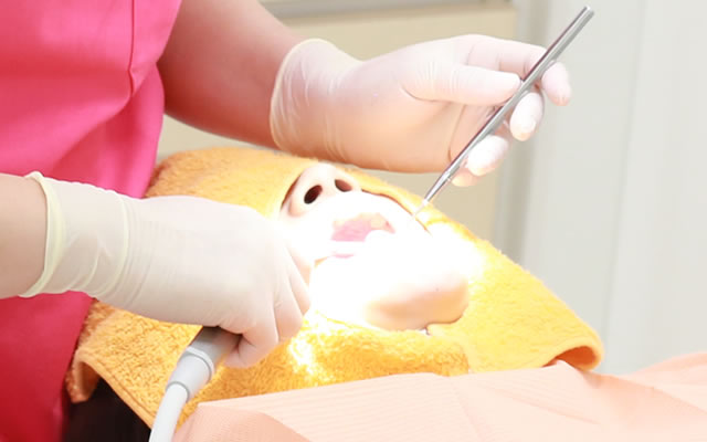 歯科技工士によるかぶせ物の制作